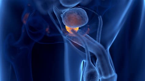 rostata|prostata wofür ist die gut.